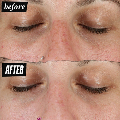 V2H74A2255C685942423E50655927F7C98BR7662244P5